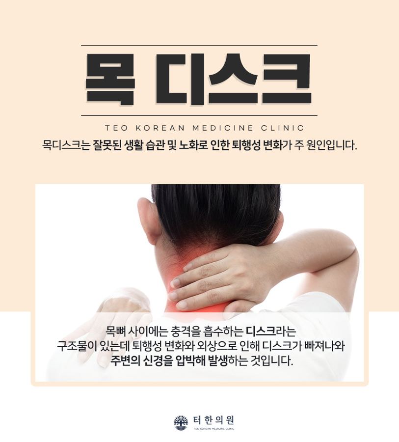 목 디스크를 설명하는 목 통증 사진 안내문