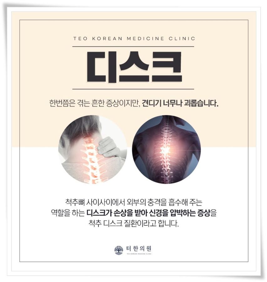 목 디스크를 설명한 인포그래픽