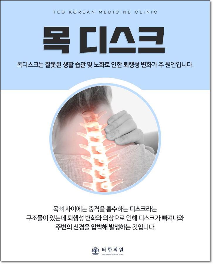 목 디스크를 설명하는 안내문