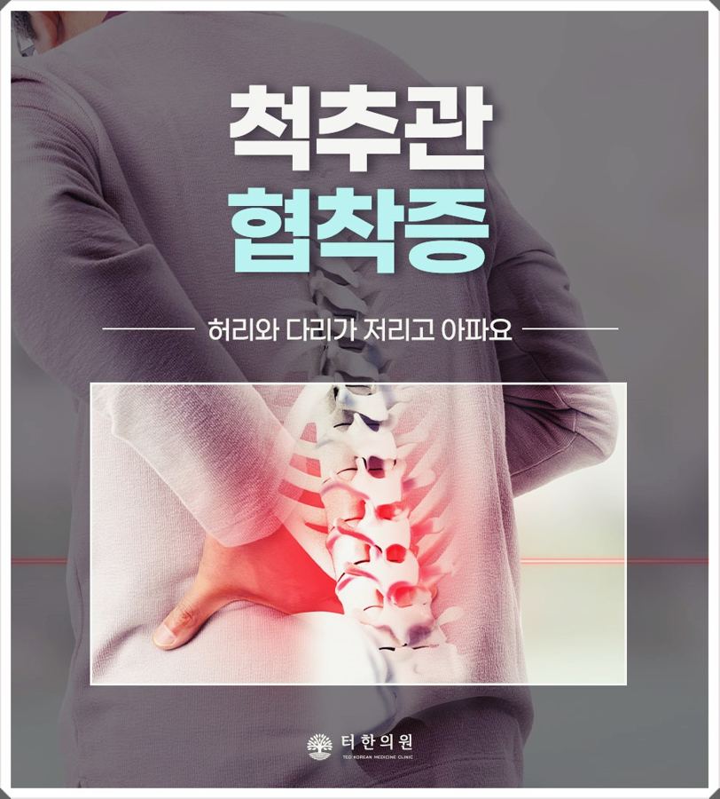 허리 통증을 표시한 협착증 안내문