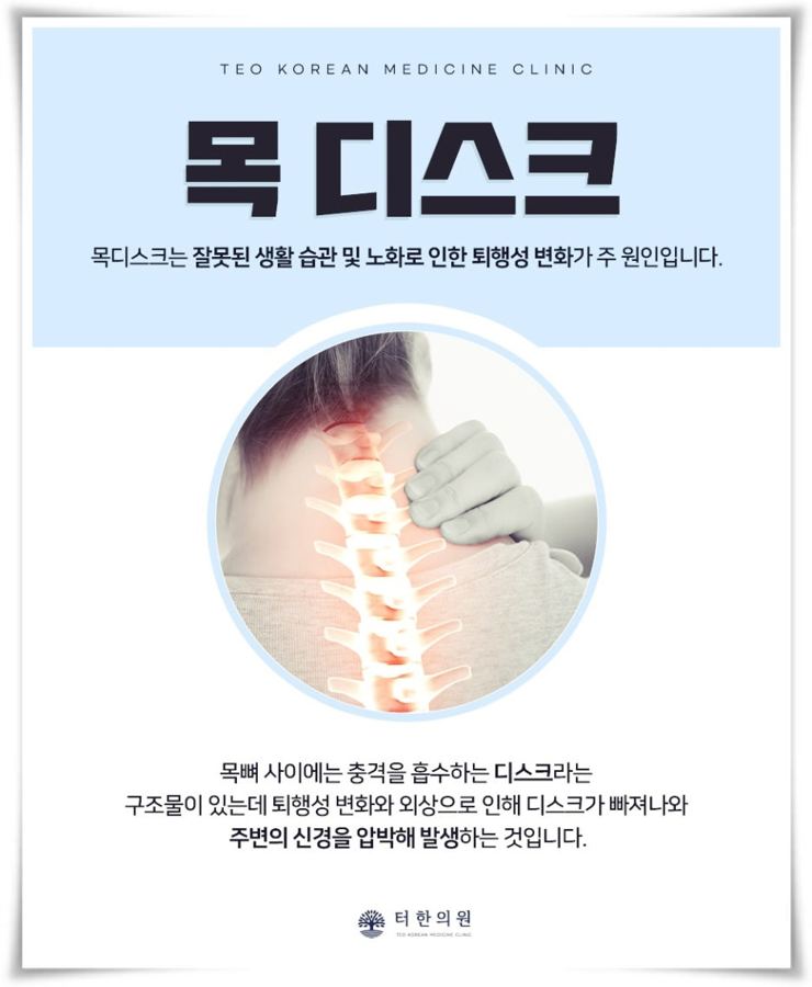 목 디스크를 설명한 안내문