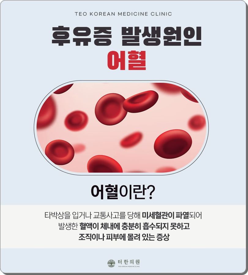 어혈의 의미와 생활 관리 방법을 설명한 안내문